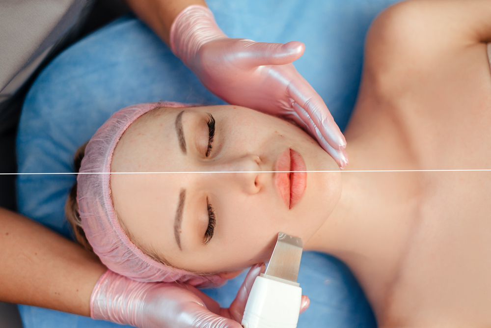 Ultragarsinis veido valymas: prieš ir po